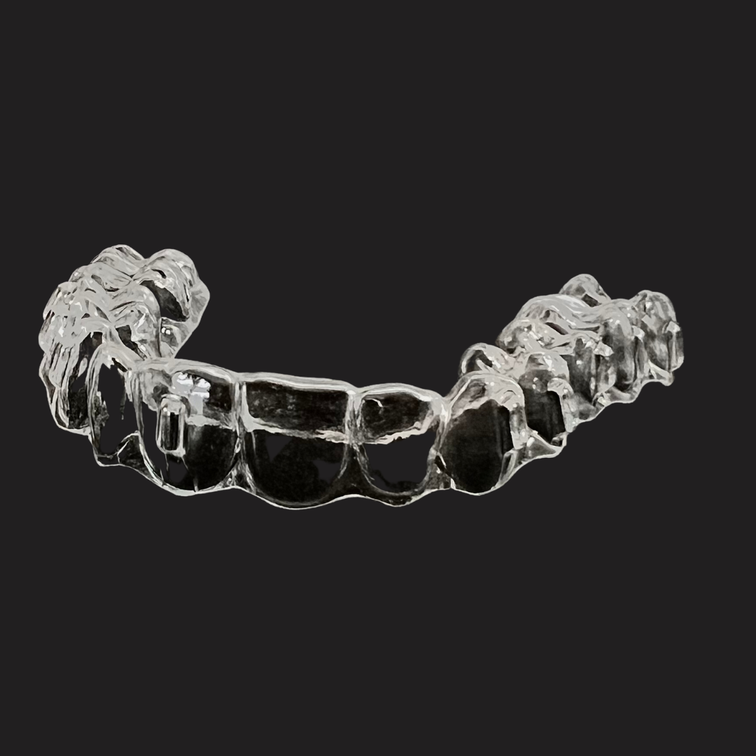 Lime Aligners